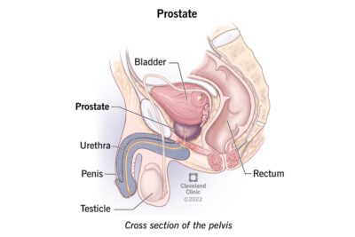 23965-prostate